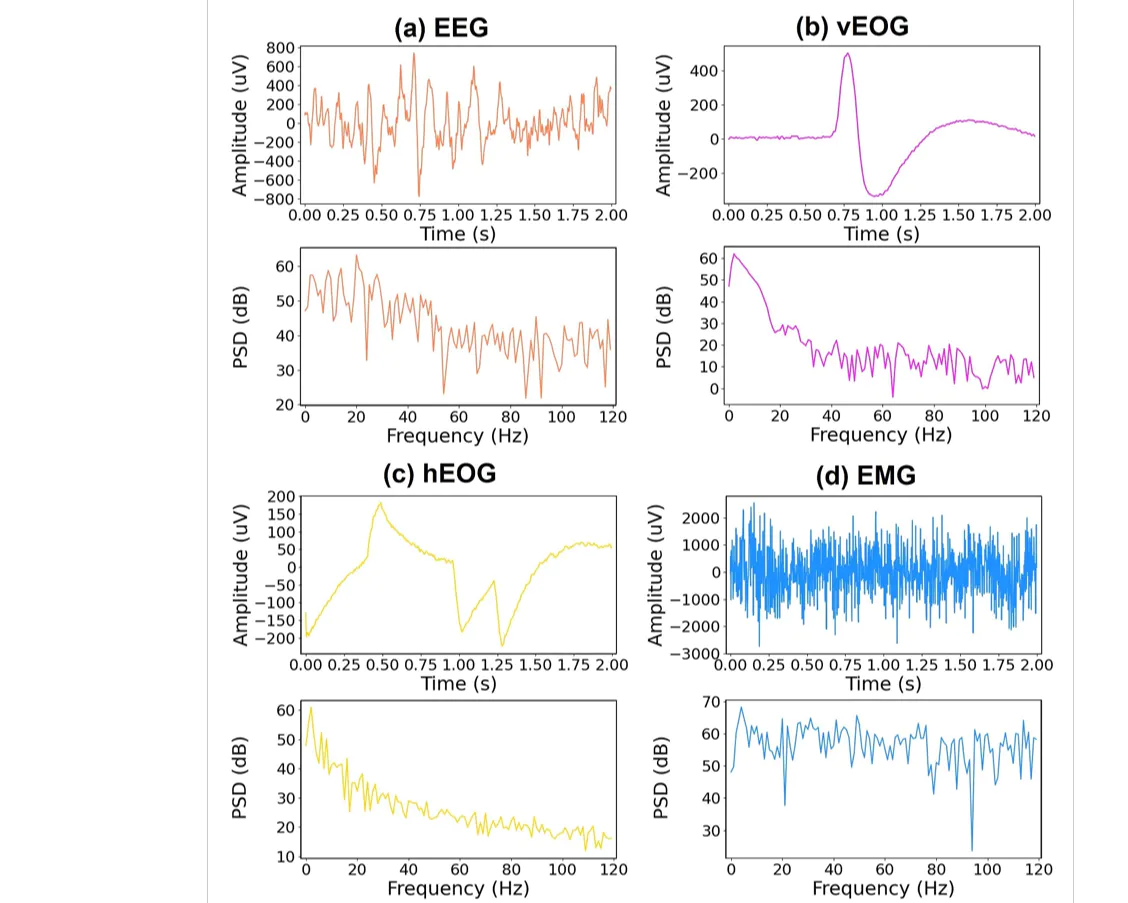 EEGdenoiseNet: a benchmark dataset for deep learning solutions of EEG denoising 论文配图